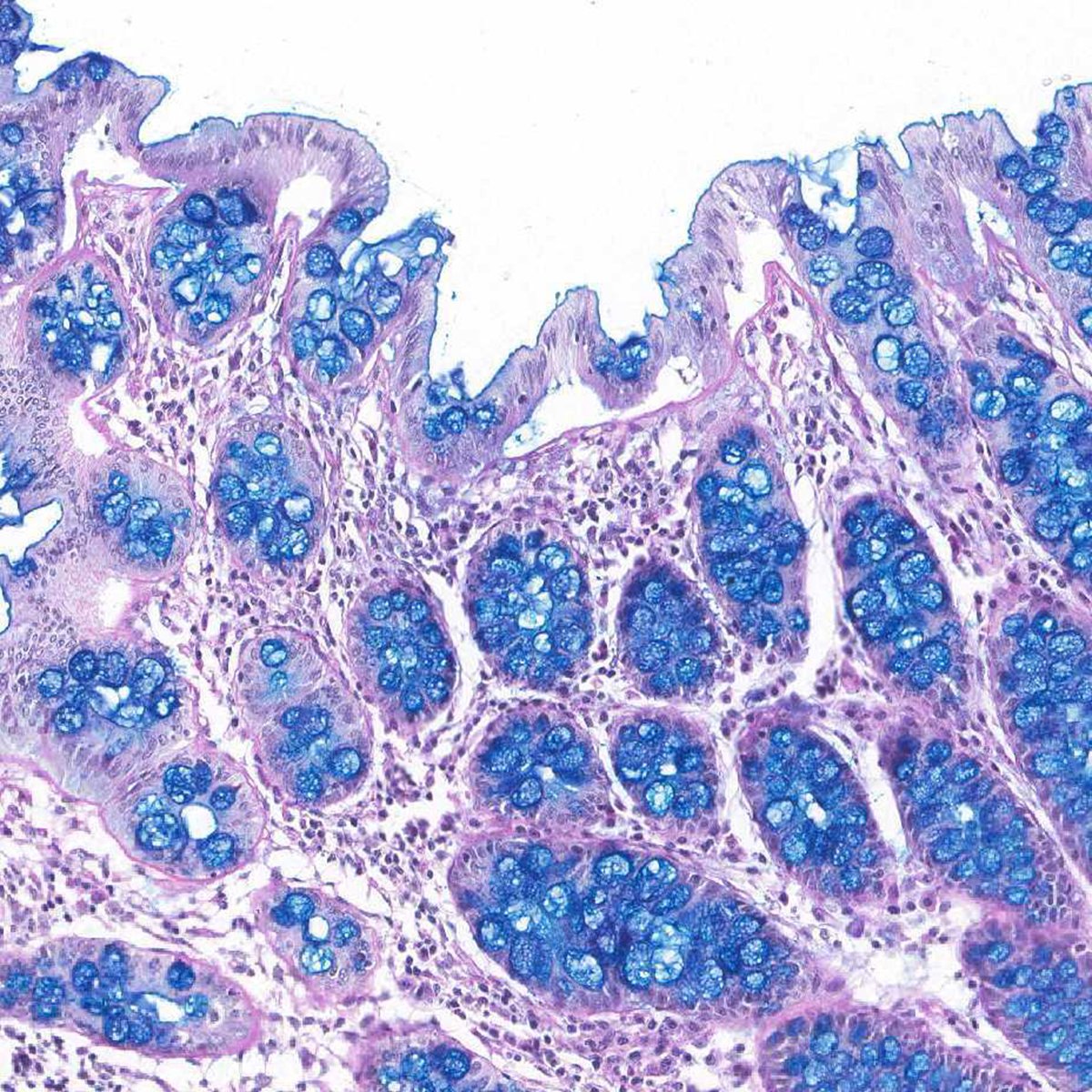 Foto de uma Coloração Especial Alcian Blue - Kit de Coloração Especial HistoKit Alcian Blue