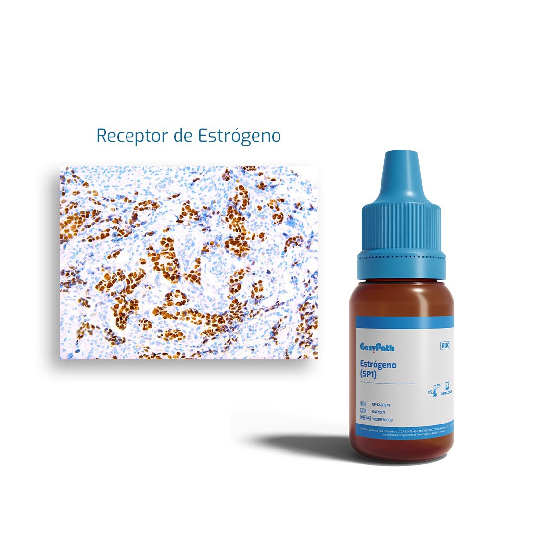 receptor-de-estrogeno-SP1-HERO