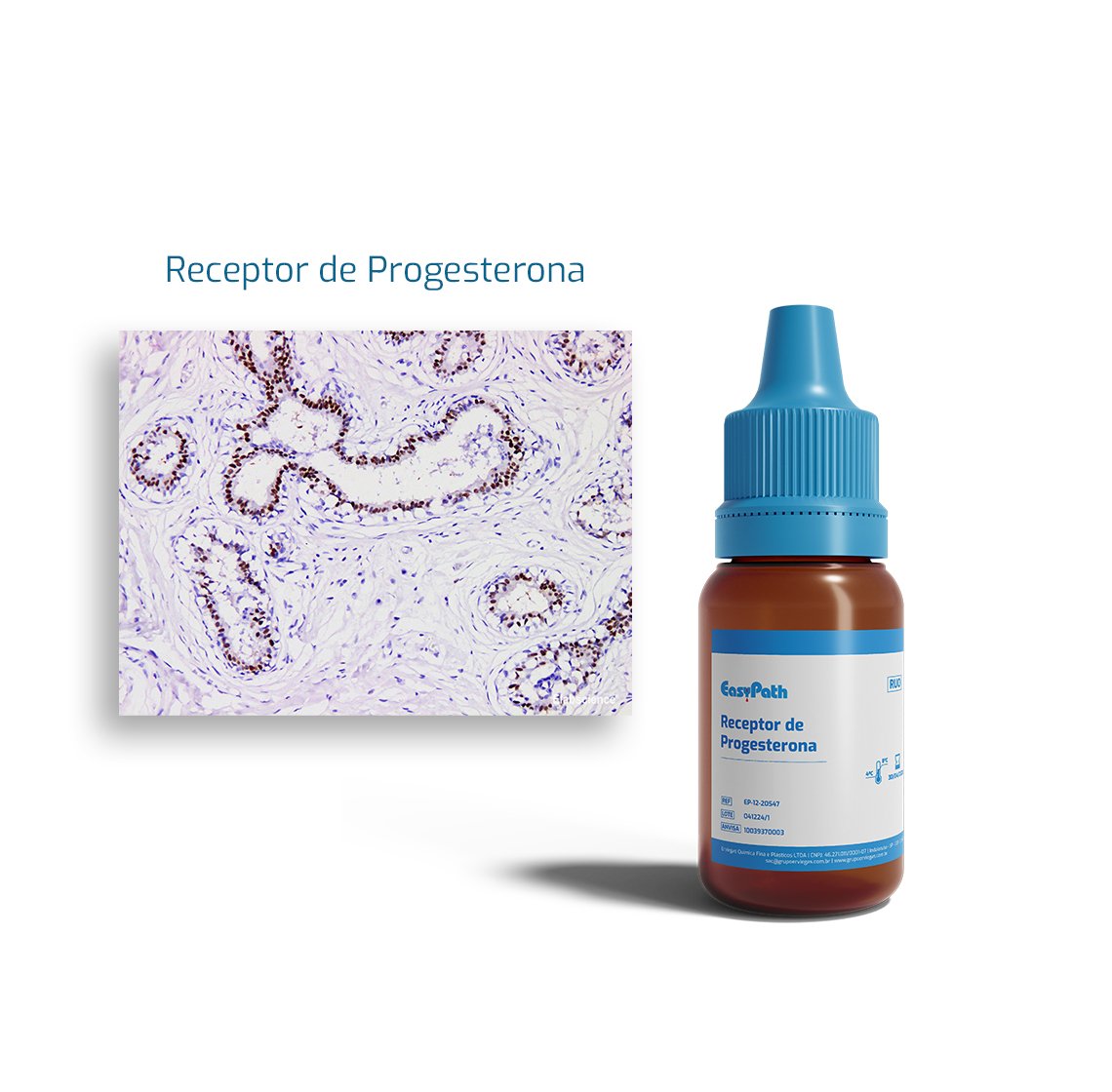 receptor-de-progesterona-HERO-02