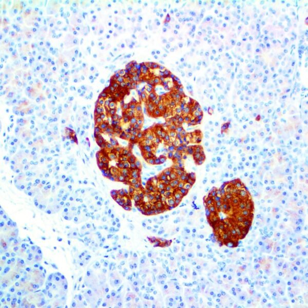 CD56/NCAM-1, clone 123C3