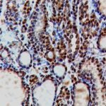 MLH-1, clon BS29