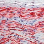 Neurofilamento 70/200kDA, clon 2F11