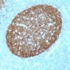 Anticorpo Recombinante BOB-1QR072 OncoTrace EasyPath