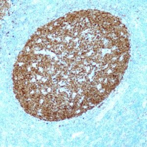 Anticorpo Recombinante BOB-1QR072 OncoTrace EasyPath