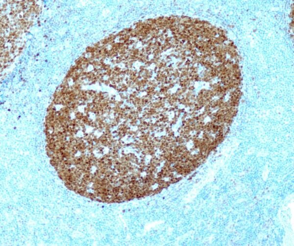Anticorpo Recombinante BOB-1QR072 OncoTrace EasyPath