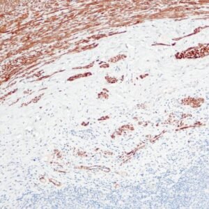 Anticorpo Recombinante OncoTrace Desmina QR026 EasyPath