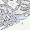 Anticorpo Recombinante OncoTrace PAX8 (Clone QR016) EasyPath