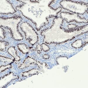 Anticorpo Recombinante OncoTrace PAX8 (Clone QR016) EasyPath