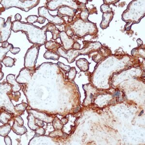 Anticorpo Recombinante OncoTrace PLAP (Clone QR084) EasyPath