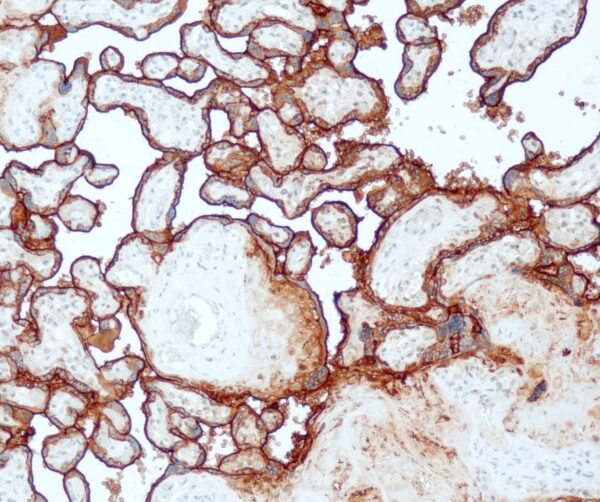 Anticorpo Recombinante OncoTrace PLAP (Clone QR084) EasyPath