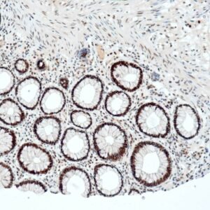 Anticorpo Recombinante OncoTrace PMS2 (Clone QR084) EasyPath