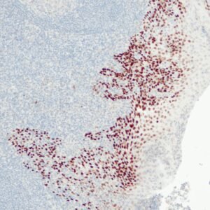 Anticorpo Recombinante OncoTrace p40 (Clone QR020) EasyPath