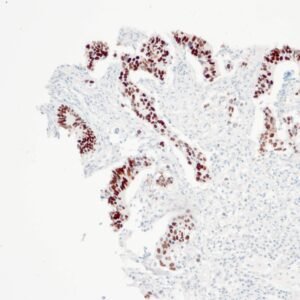 Anticorpo Recombinante OncoTrace p53 (Clone QR025) EasyPath