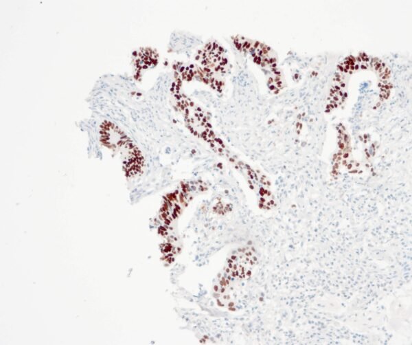 Anticorpo Recombinante OncoTrace p53 (Clone QR025) EasyPath