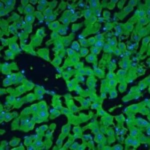 Anticorpo FITC - Anti-Human Albumin – Concentrado EasyPath