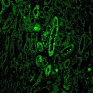 Anticorpo FITC - Anti-Human C1Q - Concentrado EasyPath