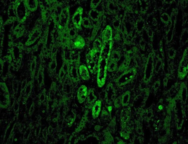 Anticorpo FITC - Anti-Human C1Q - Concentrado EasyPath