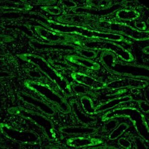 Anticorpo FITC - Anti-Human C4 – Concentrado EasyPath