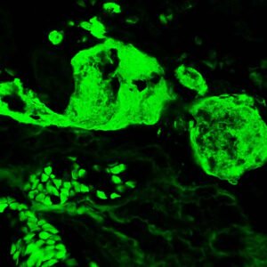 Anticorpo FITC - Anti-Human Fibrinogen - Concentrado EasyPath