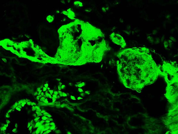 Anticorpo FITC - Anti-Human Fibrinogen - Concentrado EasyPath