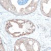 Anticorpo Oncotrace C-erbB-2 Her-2, clone QR003