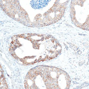 Anticorpo Oncotrace C-erbB-2 Her-2, clone QR003