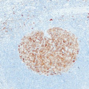 Anticorpo Oncotrace CD10, clone QR021