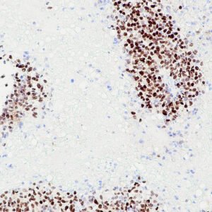Anticorpo Oncotrace GATA-3, clone QR018