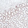 Anticorpo Oncotrace MLH1, clone QM003