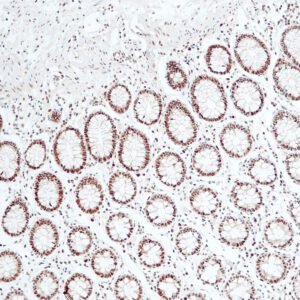 Anticorpo Oncotrace MLH1, clone QM003