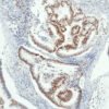 Anticorpo Oncotrace MSH6, clone QR011