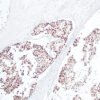 Anticorpo Oncotrace Receptor de Estrógeno, clone QR013