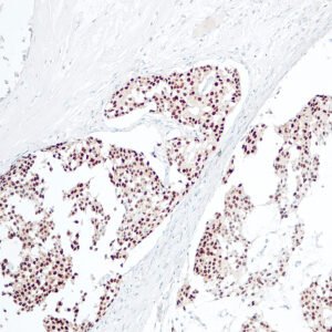 Anticorpo Oncotrace Receptor de Estrógeno, clone QR013