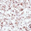 Anticorpo Oncotrace Receptor de Progesterona, clone QR014
