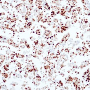 Anticorpo Oncotrace Receptor de Progesterona, clone QR014